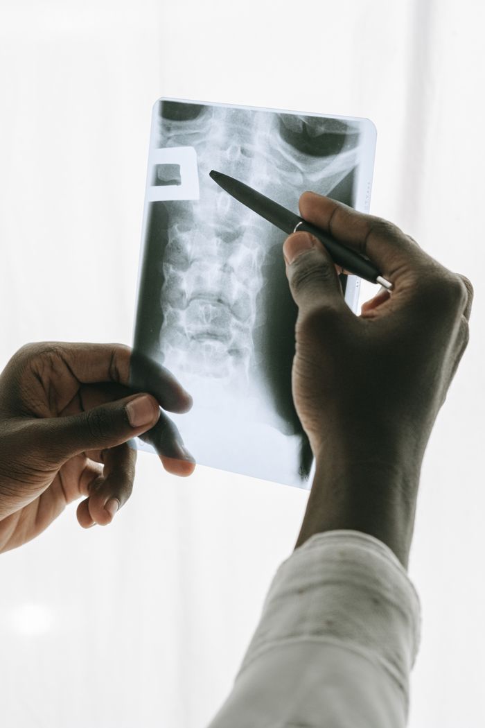 A radiologist examines an x-ray of a thorax, highlighting medical analysis.