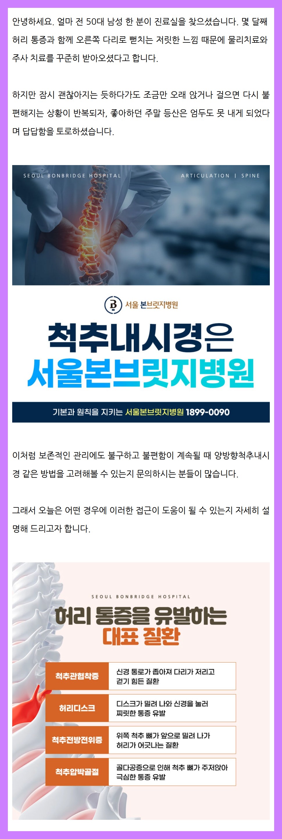 척추내시경1