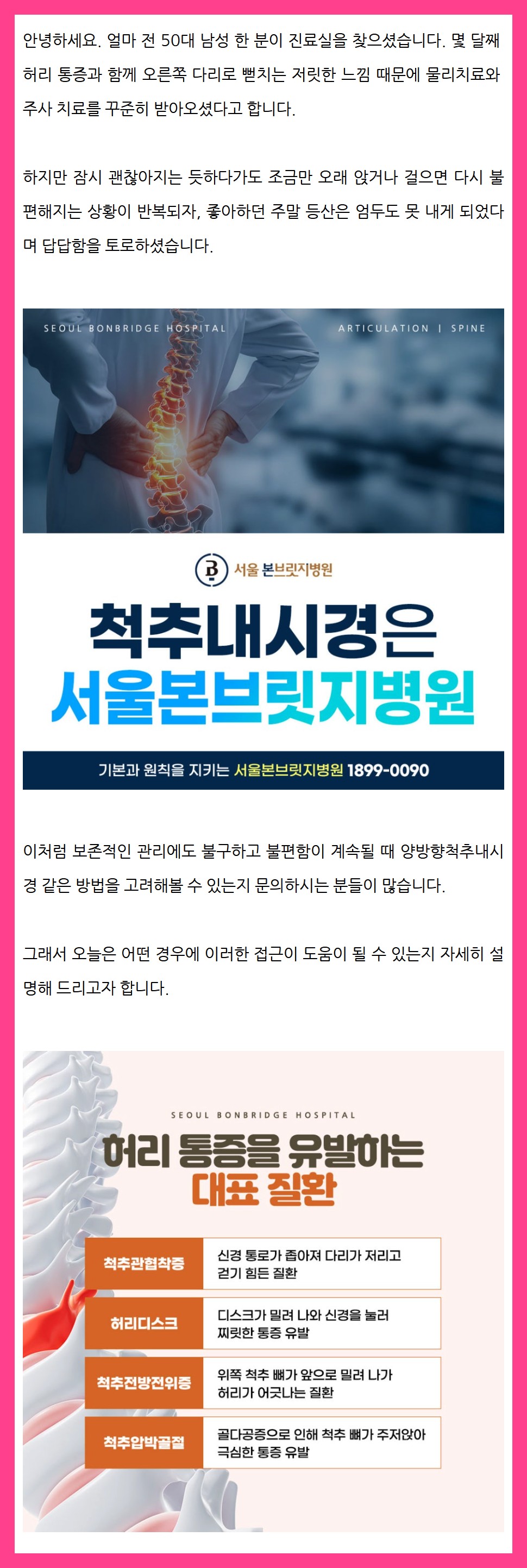 척추내시경1